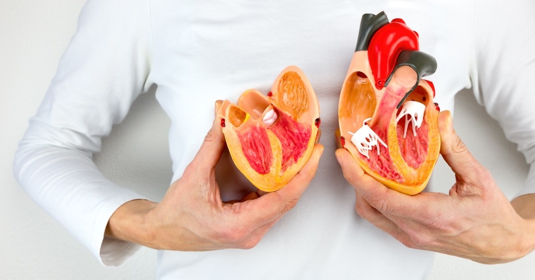 Koronarna bolest srca – Tiha opasnost koje mnoge žene nisu svjesne